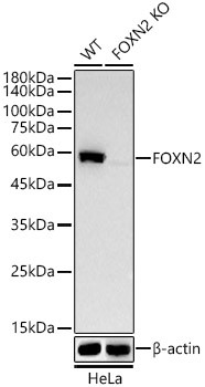 FOXN2 Antibody in Western Blot (WB)