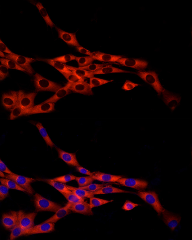 FRAT1 Antibody in Immunocytochemistry (ICC/IF)