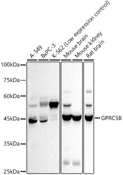 GPRC5B Antibody in Western Blot (WB)