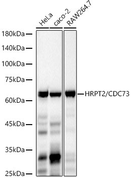 CDC73 Antibody in Western Blot (WB)
