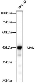 MVK Antibody in Western Blot (WB)