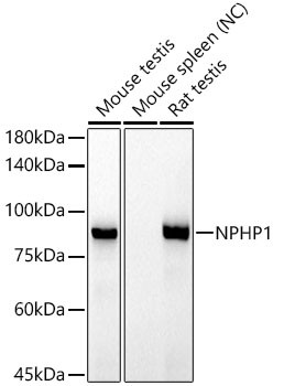NPHP1 Antibody in Western Blot (WB)