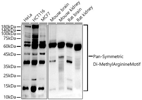 Symmetric Di-Methyl Arginine Antibody in Western Blot (WB)