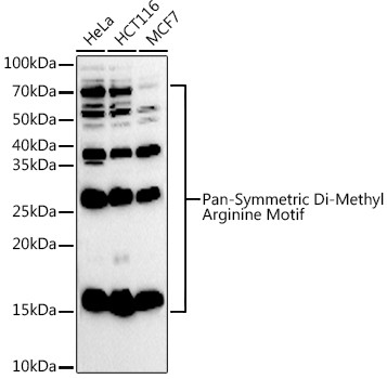 Symmetric Di-Methyl Arginine Antibody in Western Blot (WB)