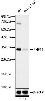 PHF11 Antibody in Western Blot (WB)