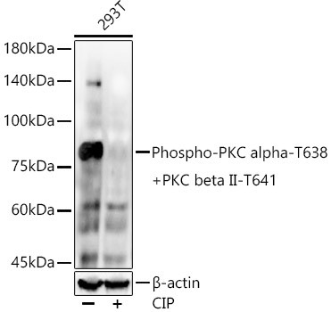 Phospho-PKC alpha/beta-2 (Thr638, Thr641) Antibody in Western Blot (WB)