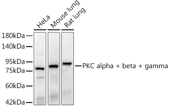 PKC alpha/beta/gamma Antibody in Western Blot (WB)