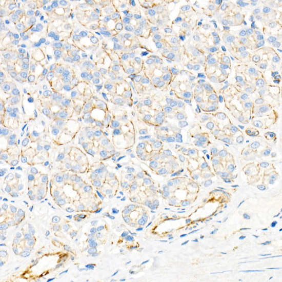 Plectin Antibody in Immunohistochemistry (Paraffin) (IHC (P))