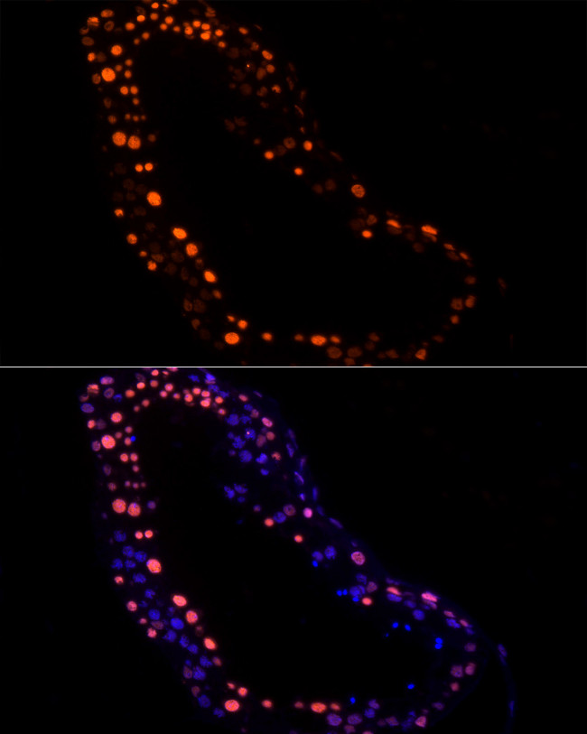 RBMXL2 Antibody in Immunocytochemistry (ICC/IF)