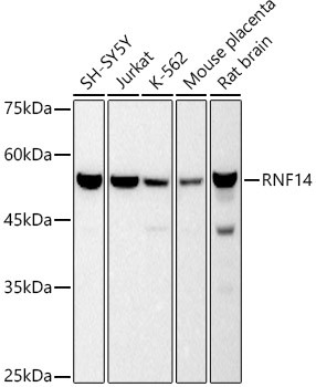 RNF14 Antibody in Western Blot (WB)
