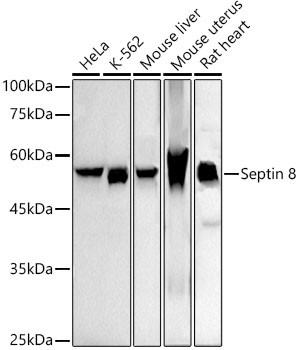 Septin-8 Antibody in Western Blot (WB)
