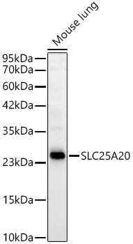 SLC25A20 Antibody in Western Blot (WB)