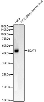 SOAT1 Antibody in Western Blot (WB)