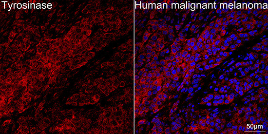 Tyrosinase Antibody in Immunohistochemistry (Paraffin) (IHC (P))