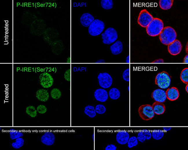 Phospho-IRE1 alpha (Ser724) Antibody in Immunocytochemistry (ICC/IF)
