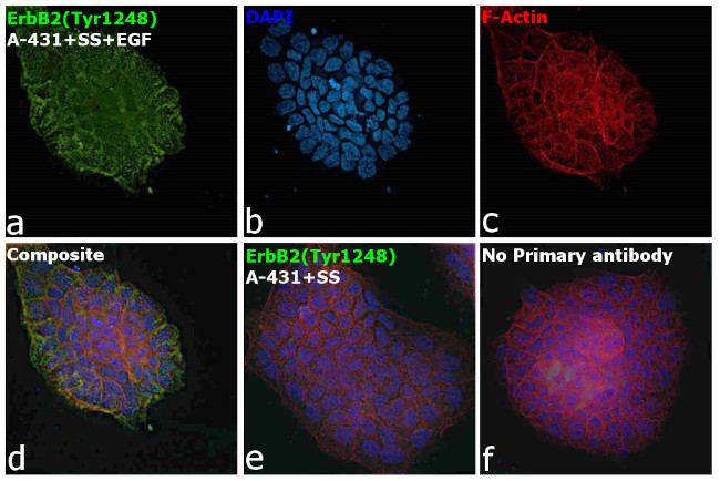 Phospho-ErbB2 (HER-2) (Tyr1248) Antibody in Immunocytochemistry (ICC/IF)