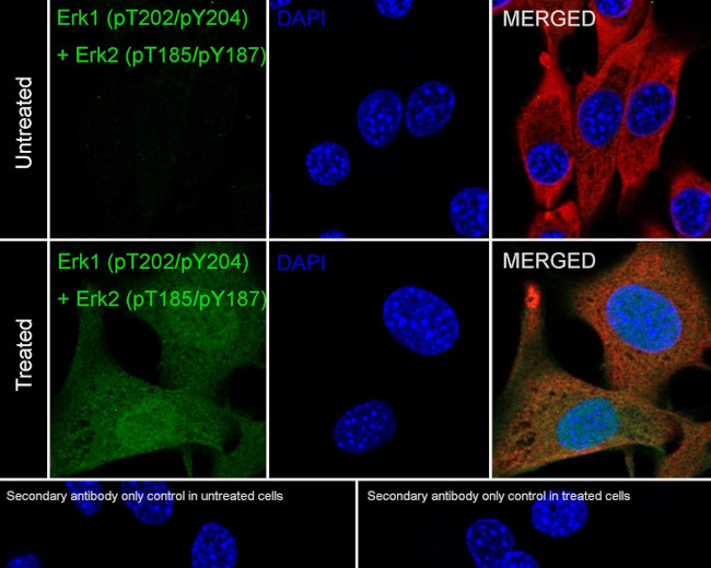 Phospho-ERK1/ERK2 (Thr202, Tyr204, Thr185, Tyr187) Antibody in Immunocytochemistry (ICC/IF)
