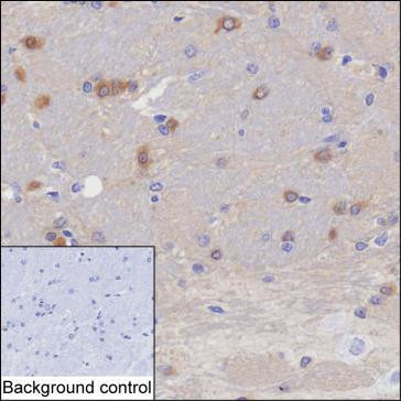 MAPRE2 Antibody in Immunohistochemistry (Paraffin) (IHC (P))