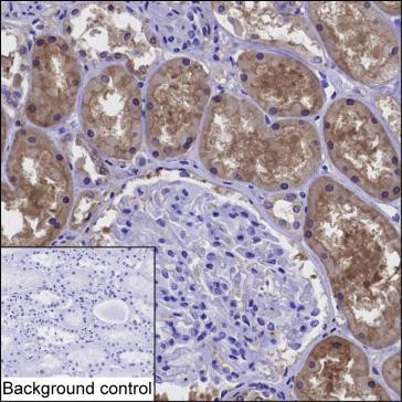 DDAH1 Antibody in Immunohistochemistry (Paraffin) (IHC (P))
