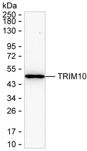 TRIM10 Antibody in Western Blot (WB)