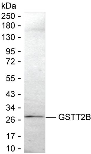 GSTT2B Antibody in Western Blot (WB)