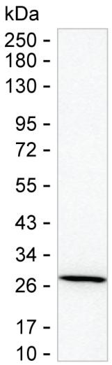 GSTT2B Antibody in Western Blot (WB)