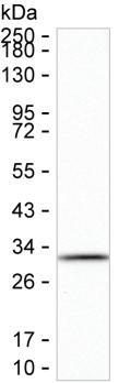Carbonic Anhydrase I Antibody in Western Blot (WB)