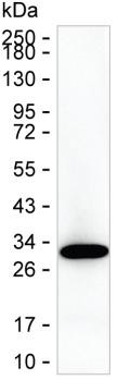Carbonic Anhydrase I Antibody in Western Blot (WB)