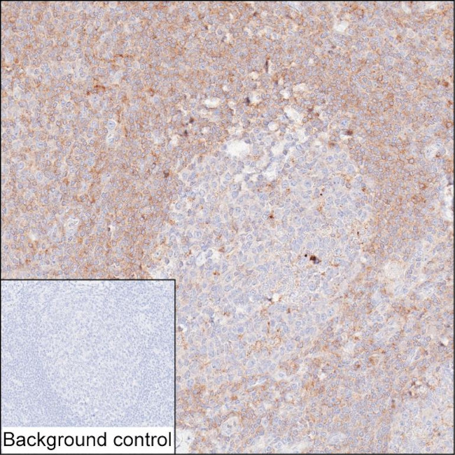 PKC beta Antibody in Immunohistochemistry (Paraffin) (IHC (P))