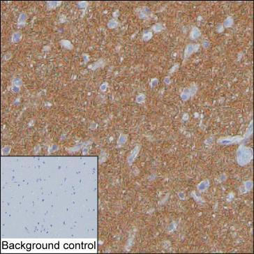 SV2A Antibody in Immunohistochemistry (Paraffin) (IHC (P))