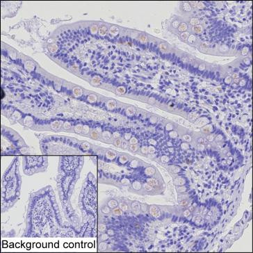 MIP-1 delta Antibody in Immunohistochemistry (Paraffin) (IHC (P))