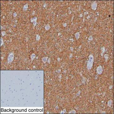 SV2A Antibody in Immunohistochemistry (Paraffin) (IHC (P))