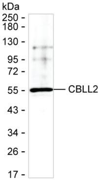 ZNF645 Antibody in Western Blot (WB)