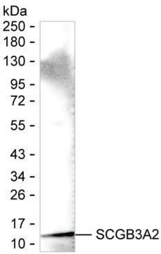UGRP1 Antibody in Western Blot (WB)