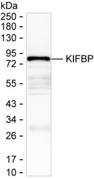 KBP Antibody in Western Blot (WB)