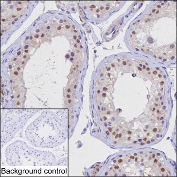 KPNA1 Antibody in Immunohistochemistry (Paraffin) (IHC (P))