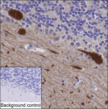 DGKZ Antibody in Immunohistochemistry (Paraffin) (IHC (P))