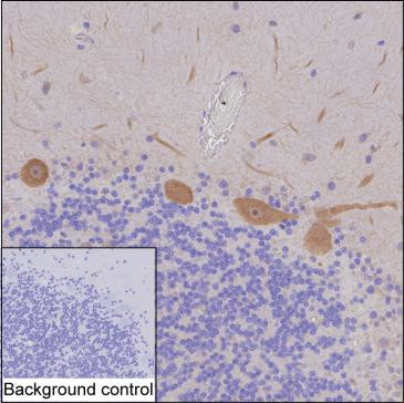 DGKZ Antibody in Immunohistochemistry (Paraffin) (IHC (P))
