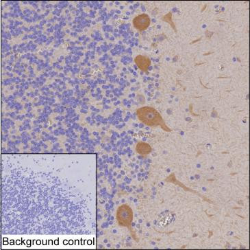 DGKZ Antibody in Immunohistochemistry (Paraffin) (IHC (P))