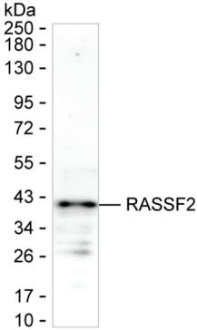 RASSF2 Antibody in Western Blot (WB)