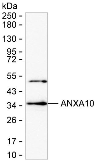 Annexin A10 Antibody in Western Blot (WB)