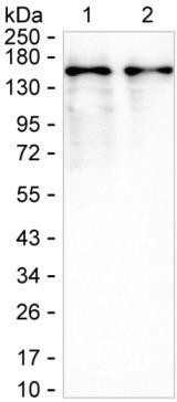 SKIV2L Antibody in Western Blot (WB)
