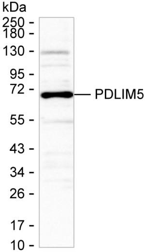 PDLIM5 Antibody in Western Blot (WB)