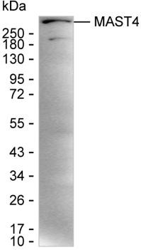 MAST4 Antibody in Western Blot (WB)