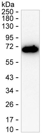 PDLIM5 Antibody in Western Blot (WB)