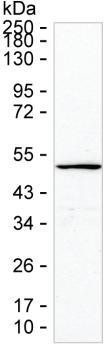 Cytokeratin 23 Antibody in Western Blot (WB)