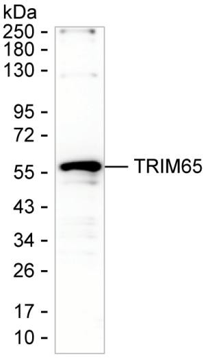 TRIM65 Antibody in Western Blot (WB)