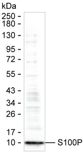 S100P Antibody in Western Blot (WB)