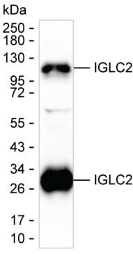 IGLC2 Antibody in Western Blot (WB)