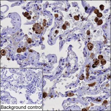 CAPG Antibody in Immunohistochemistry (Paraffin) (IHC (P))
